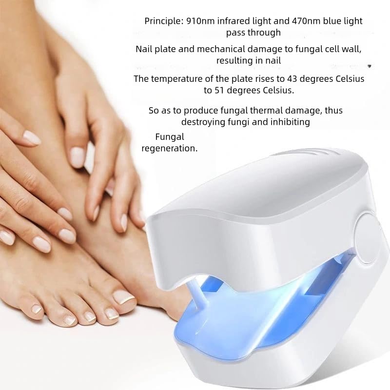 Portable Nail Fungus Laser Therapy – Blue Light Device for Safe & Effective Toenail Repair - O'Homely