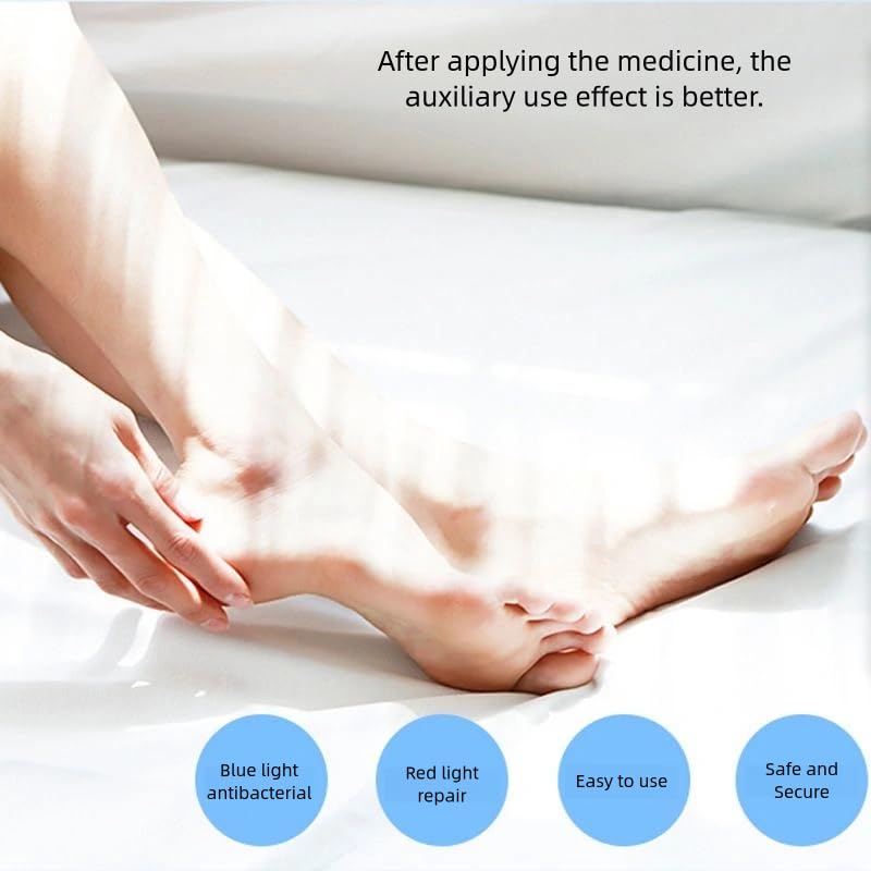 Portable Nail Fungus Laser Therapy – Blue Light Device for Safe & Effective Toenail Repair - O'Homely