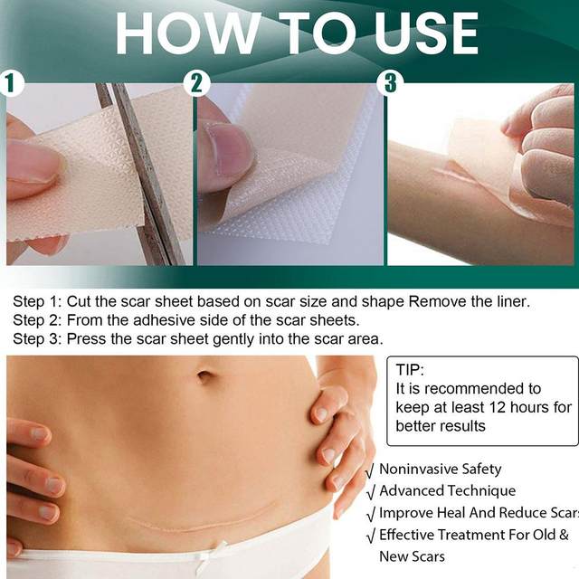 Silicone Scar Tape Roll – Surgical, C - Section, Keloid, Tummy Tuck Scar Removal - O'Homely