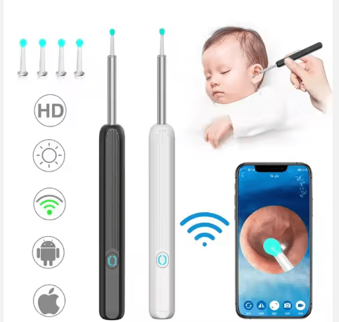 Wireless Ear Wax Remover with HD Camera – iOS & Android Compatible - O'Homely